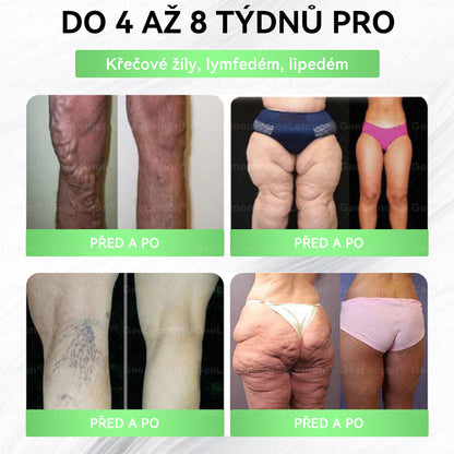 🌿🌿Doporučeno Fakultní nemocnicí Motol ·  Oficiální prodejna BENU | 🎁 𝐆𝐞𝑒𝑙𝑒𝐦𝐨𝐧® Glum𝐚𝐬𝐞tide 8 v 1 – Zeštíhlující nano mikrojihlový náplast 🇨🇿 Jen 1× denně ✅ Viditelné změny za 7 dní – na obezitu, kardiovaskulární zdraví, diabetes a kloubní problémy